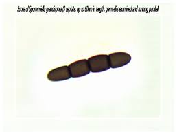 Attēlu rezultāti vaicājumam “Lycogala asperum young”