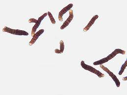 Attēlu rezultāti vaicājumam “Orthotrichum lyellii”