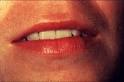 Figure 2 - <b>Lips</b>