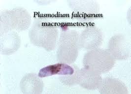 Attēlu rezultāti vaicājumam “Oligonema favogineum plasmodium”