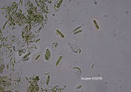 Attēlu rezultāti vaicājumam “Microcalicium disseminatum”