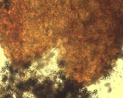 Attēlu rezultāti vaicājumam “Ophiostoma polyporicola”