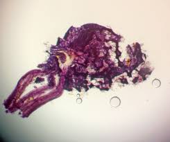 Attēlu rezultāti vaicājumam “Cribraria rubiginosa spores”