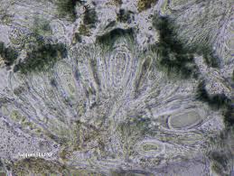 Attēlu rezultāti vaicājumam “Mycoblastus sanguinarius”