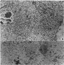 Attēlu rezultāti vaicājumam “Diderma testaceum young”