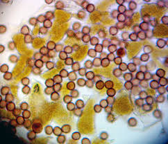 Attēlu rezultāti vaicājumam “Lignydium muscorum young”