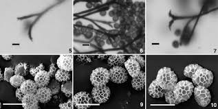 Attēlu rezultāti vaicājumam “Physarum straminipes spores”