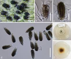 Attēlu rezultāti vaicājumam “Diachea dictyospora (syn. Craterium dictyosporum) spores”