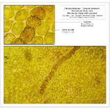 Attēlu rezultāti vaicājumam “Frullania tamarisci macro”