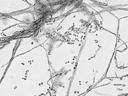 Attēlu rezultāti vaicājumam “Bjerkandera adusta”
