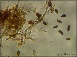 Attēlu rezultāti vaicājumam “Hypoxylon fragiforme / howeianum”