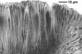 Attēlu rezultāti vaicājumam “Bacidia rubella”