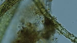 Attēlu rezultāti vaicājumam “Fuligo leviderma spores”