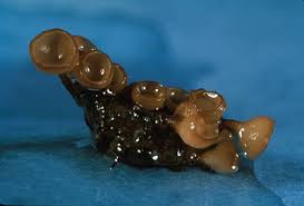 Attēlu rezultāti vaicājumam “Cribraria rubiginosa spores”