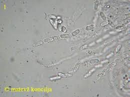 Attēlu rezultāti vaicājumam “Nectriopsis violacea”