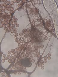 Attēlu rezultāti vaicājumam “Stemonitis fusca spores”