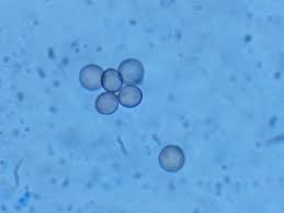 Attēlu rezultāti vaicājumam “Stemonitis lignicola spores”