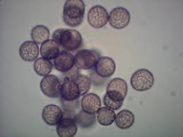 Attēlu rezultāti vaicājumam “Stemonitopsis hyperopta var. landewaldii”