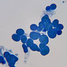 Attēlu rezultāti vaicājumam “Erythricium aurantiacum”