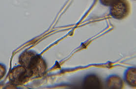 Attēlu rezultāti vaicājumam “Didymium difforme spores”