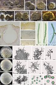 Attēlu rezultāti vaicājumam “Trichia ambigua spores”