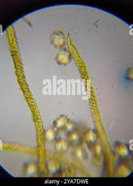 Attēlu rezultāti vaicājumam “Oligonema persimile macro”