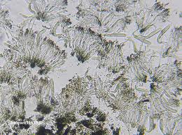 Attēlu rezultāti vaicājumam “Opegrapha rufescens”