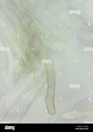 Attēlu rezultāti vaicājumam “Cudoniella acicularis”