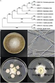 Attēlu rezultāti vaicājumam “Trichia ambigua spores”