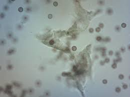 Attēlu rezultāti vaicājumam “Fuligo luteonitens macro”