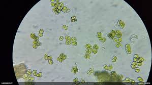 Attēlu rezultāti vaicājumam “Pleurococcus vulgaris”