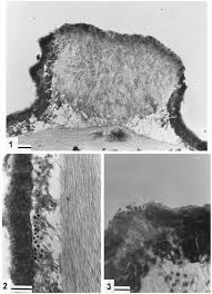Attēlu rezultāti vaicājumam “Biatoropsis usnearum”