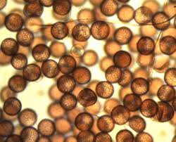 Attēlu rezultāti vaicājumam “Brefeldia maxima macro”