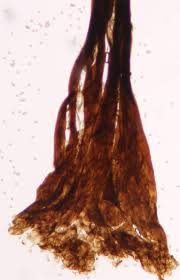 Attēlu rezultāti vaicājumam “Comatricha nigra stalked”