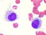 Reactive <b>Histiocytes</b> in the