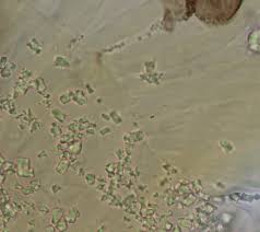 Attēlu rezultāti vaicājumam “Didymium melanospermum spores”