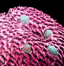 Attēlu rezultāti vaicājumam “Amaurochaete fusiformis macro”