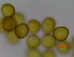 Attēlu rezultāti vaicājumam “Trichia scabra spores”