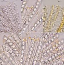 Attēlu rezultāti vaicājumam “Sowerbyella radiculata”