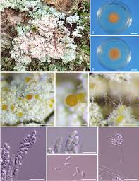 Attēlu rezultāti vaicājumam “Arcyria globosa young”