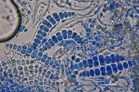 Attēlu rezultāti vaicājumam “Thelotrema lepadinum”