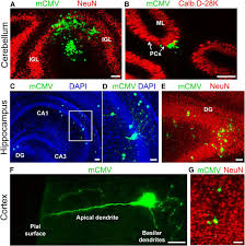Image result for Vcd Ttc