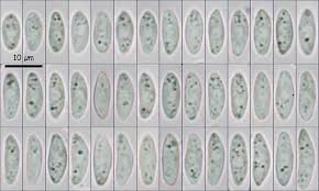 Attēlu rezultāti vaicājumam “Hymenoscyphus imberbis”