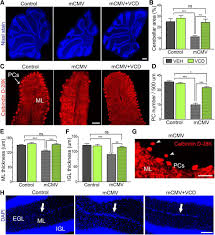Image result for Vcd Ttc