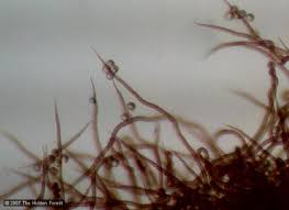 Attēlu rezultāti vaicājumam “Metatrichia sp.”