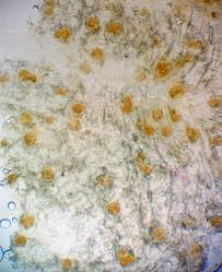 Attēlu rezultāti vaicājumam “Lycogala cf. oleocrystalliferum”