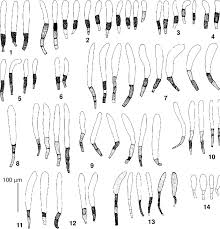 Attēlu rezultāti vaicājumam “Leptobryum pyriforme sporophyte”