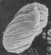 Attēlu rezultāti vaicājumam “Microcalicium disseminatum”