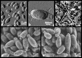 Attēlu rezultāti vaicājumam “Enteridium variabile spores”