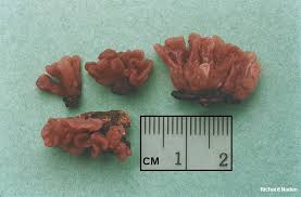 Attēlu rezultāti vaicājumam “Ascocoryne sarcoides”